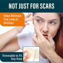 nuvadermis-clear-silicone-scar-tape-for--2.jpg
