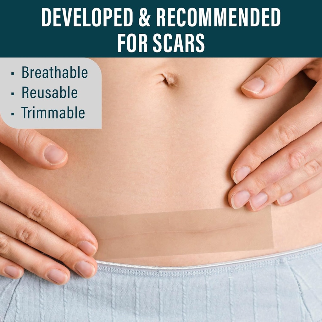 nuvadermis-clear-silicone-scar-tape-for--3.jpg